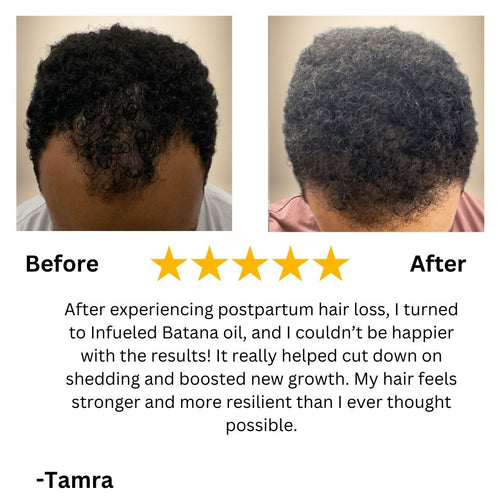 Dual Action Batana + Pumpkin Seed Oil